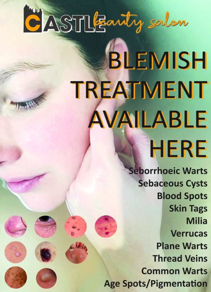blemish treatment available here, seborrhoeic warts, sebaceous cysts, blood spots, skin tags, milia, verrucas, plane warts, thread veins, common warts, age spots and pigentation